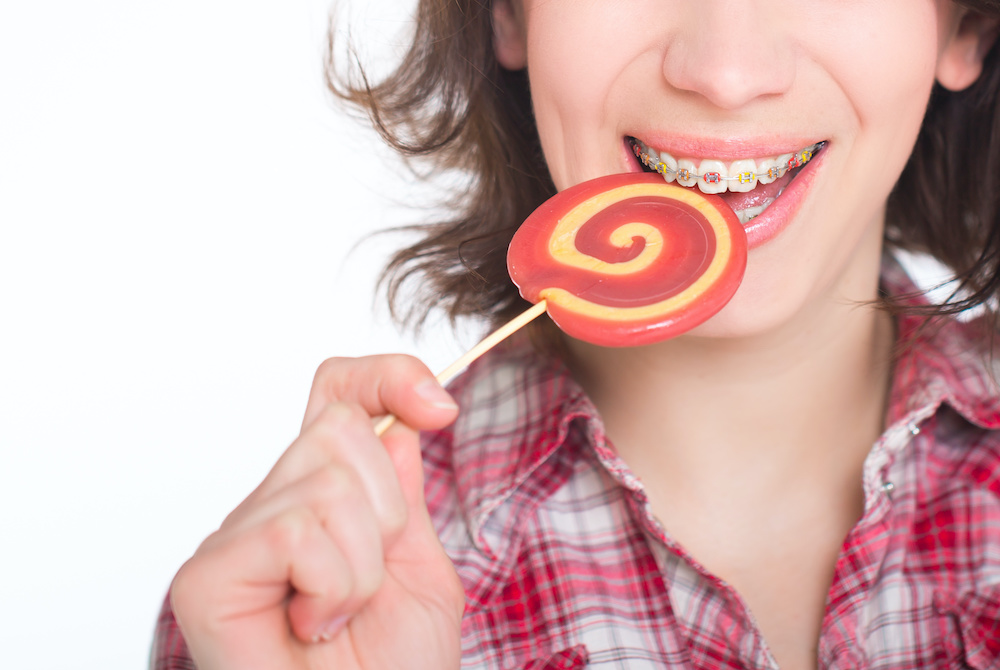 Foods To Avoid Eating With Braces Charleston Orthodontics Powered By Smile Doctors 