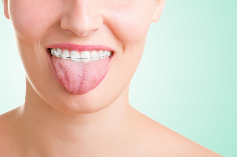 how-a-tongue-thrust-affects-your-teeth-charleston-orthodontics