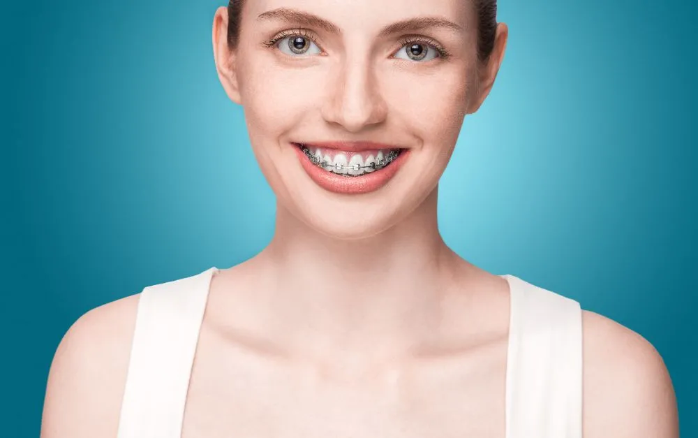 Happy women with braces
