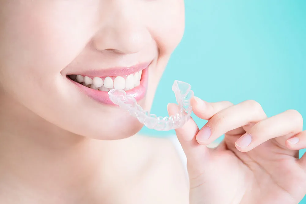 Invisalign