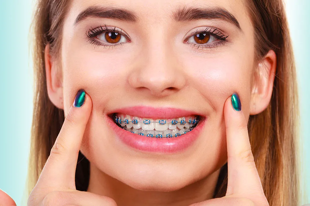Girl with braces