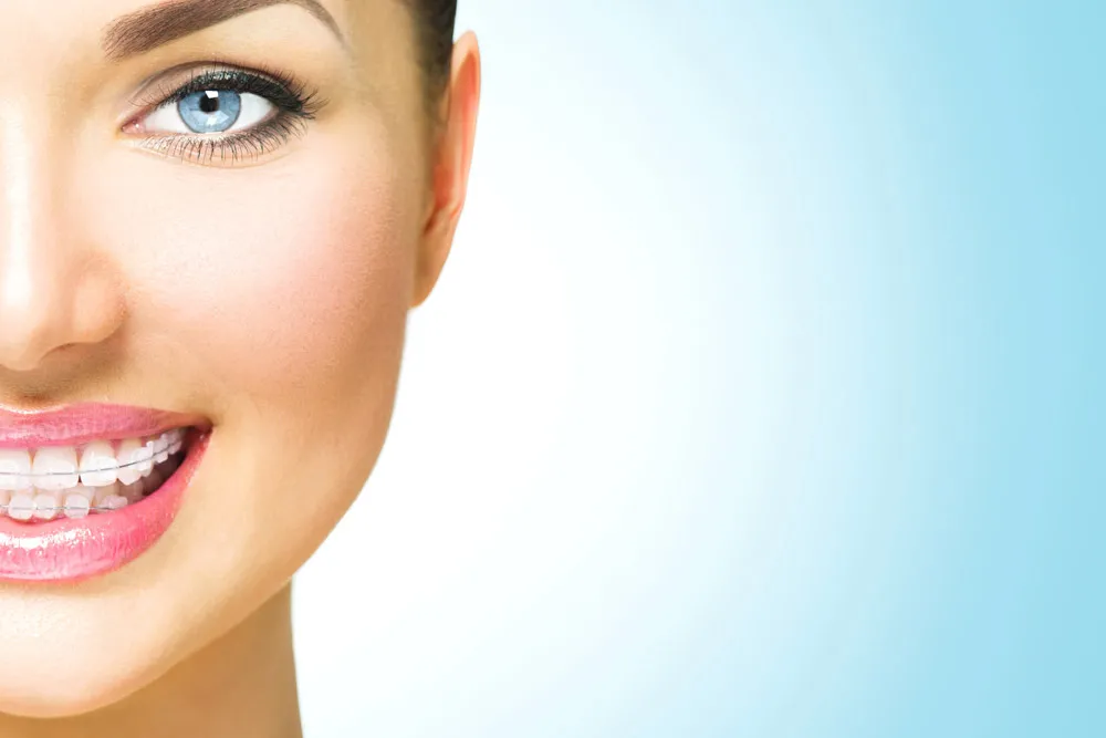 close lookup dental braces