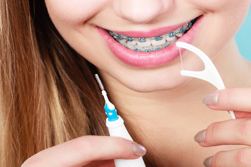 Sæt ud Uddrag balkon Finding the Right Dental Floss to Use with Braces - Charleston Orthodontics  Powered By Smile Doctors
