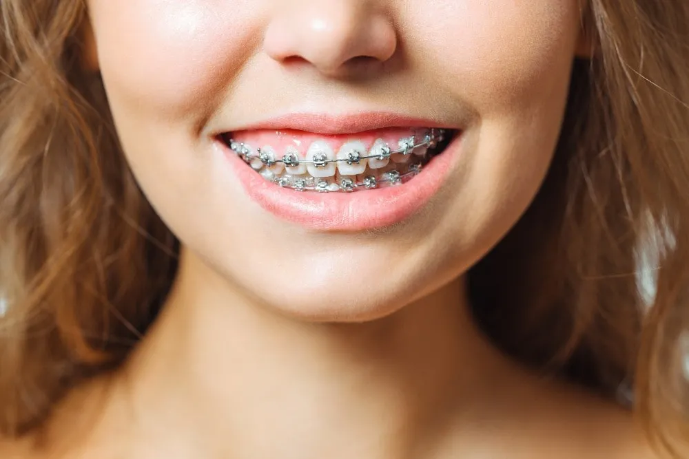 close lookup braces